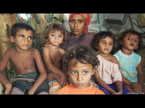 106 مليون يمني يعانون انعدام الأمن الغذائي