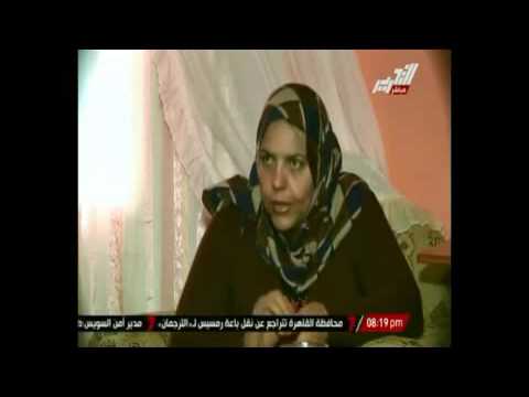 طفلة مصريَّة تعاني من مرض نادر