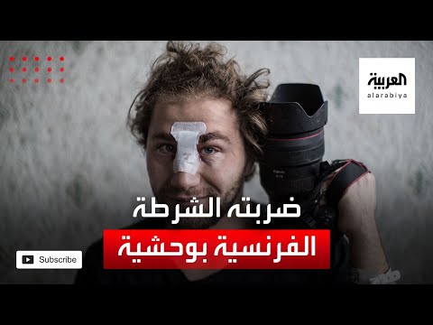 شاهد مصور سوري يروي ما تعرض له من عنف الشرطة في فرنسا